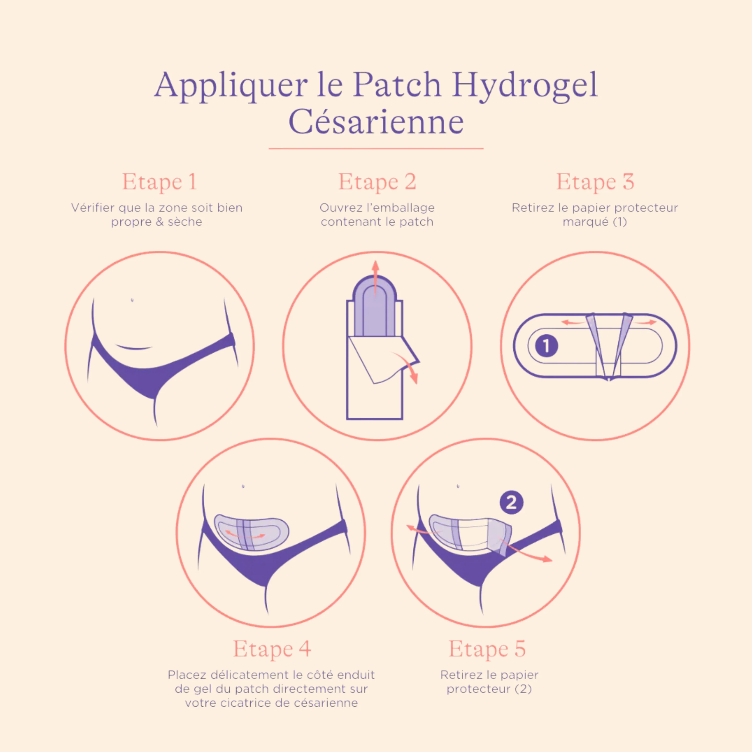 Patch Hydrogel pour Césarienne - Image 3