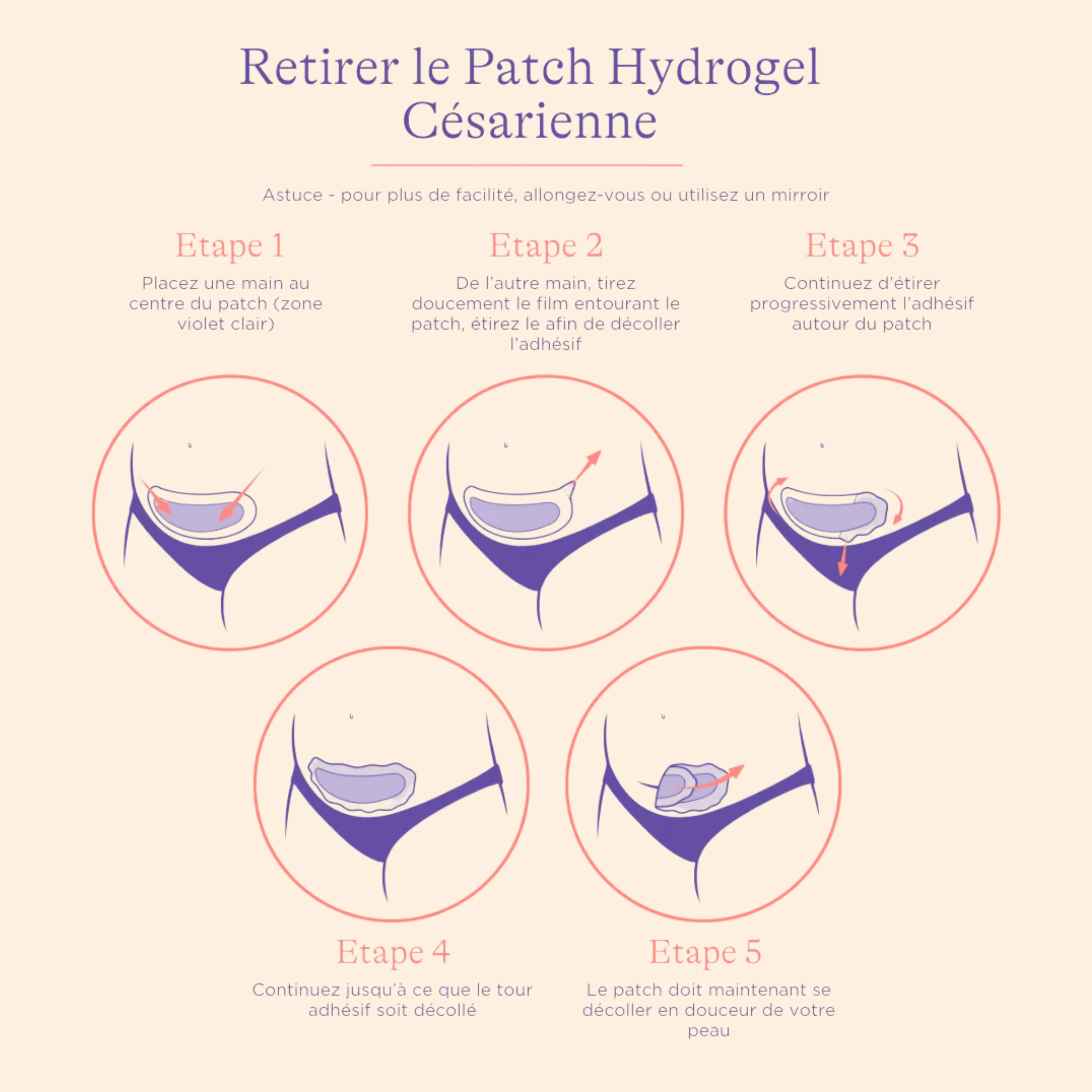 Patch Hydrogel pour Césarienne - Image 4